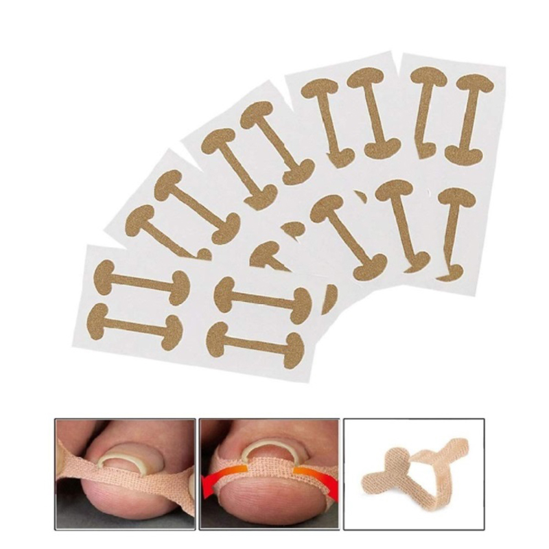 Antimicrobial Soothing Pain Paronychia Correction Nail Stickers