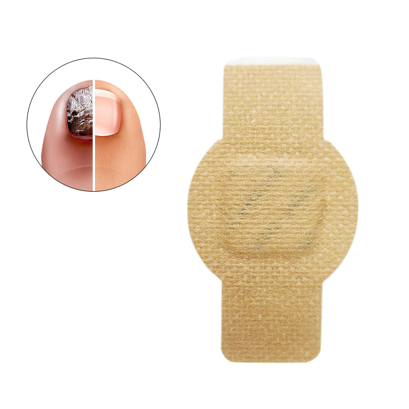 Strong Adhesion Antimicrobial Gentle Repair Onychomycosis Stickers